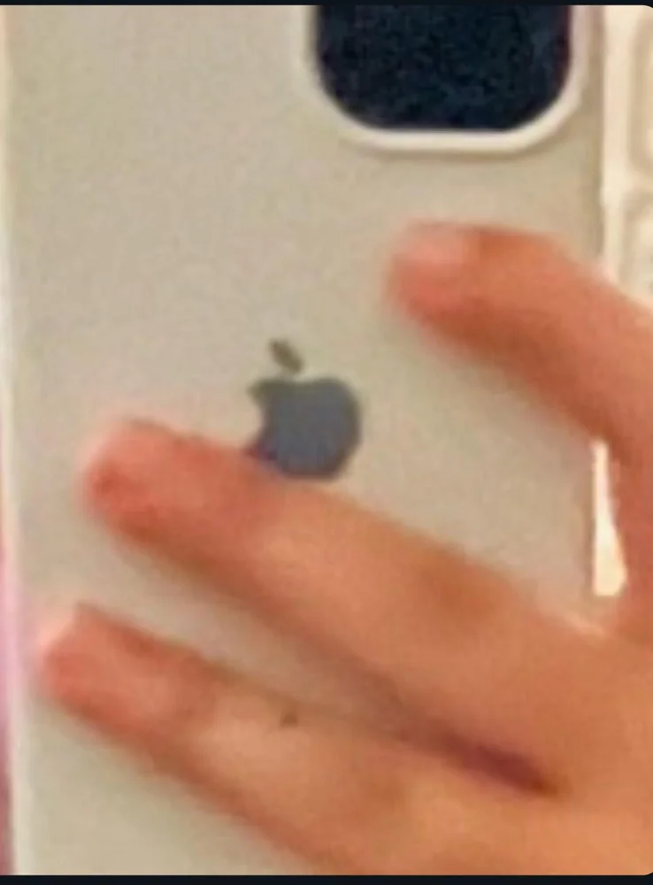 PHONE CASE Phone Cases