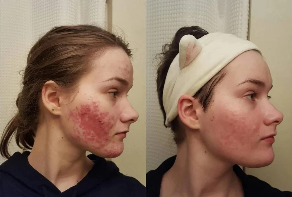 Skin care, size Other, photo 4